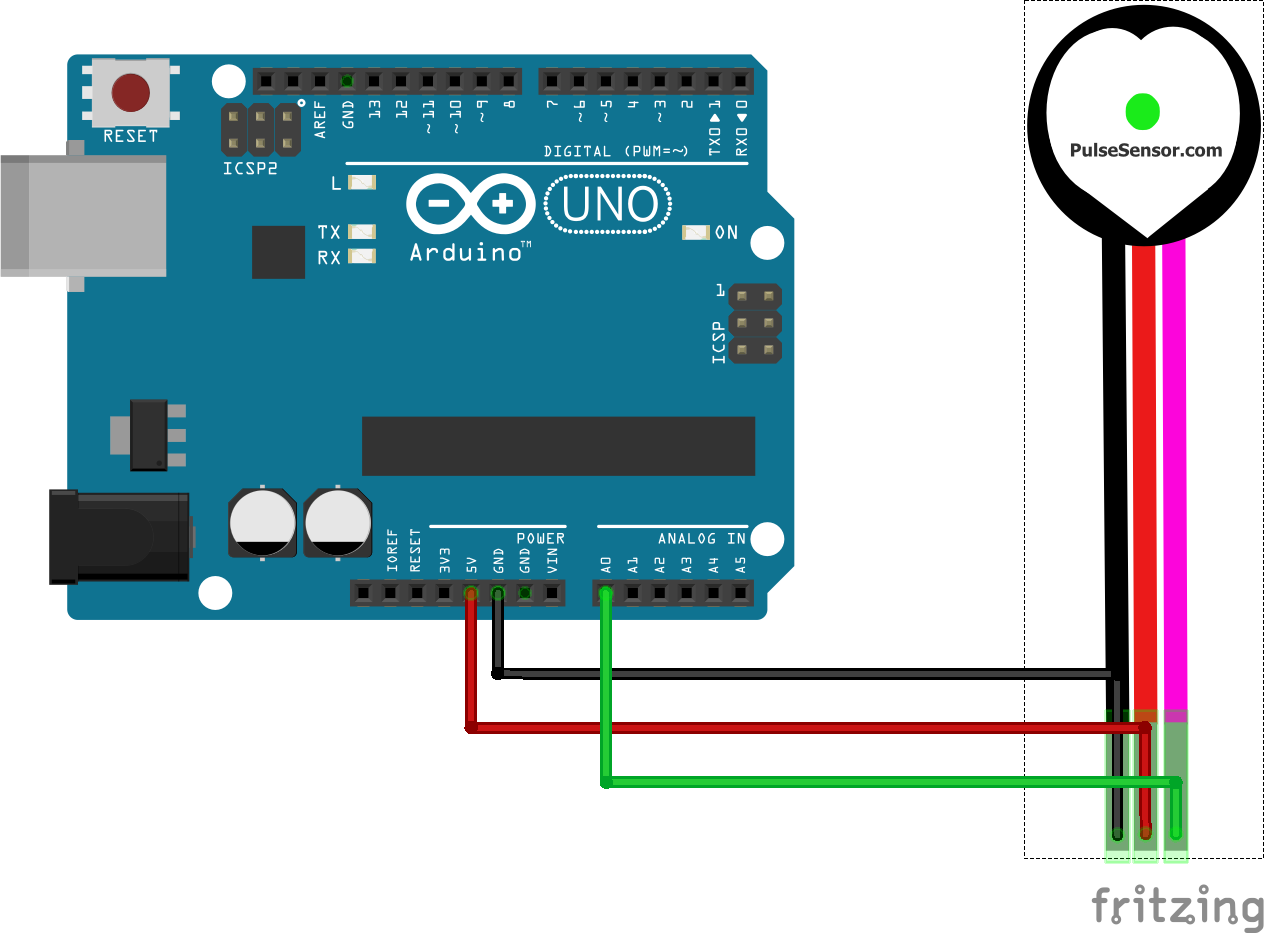 Pulse Sensor with Arduino — overview